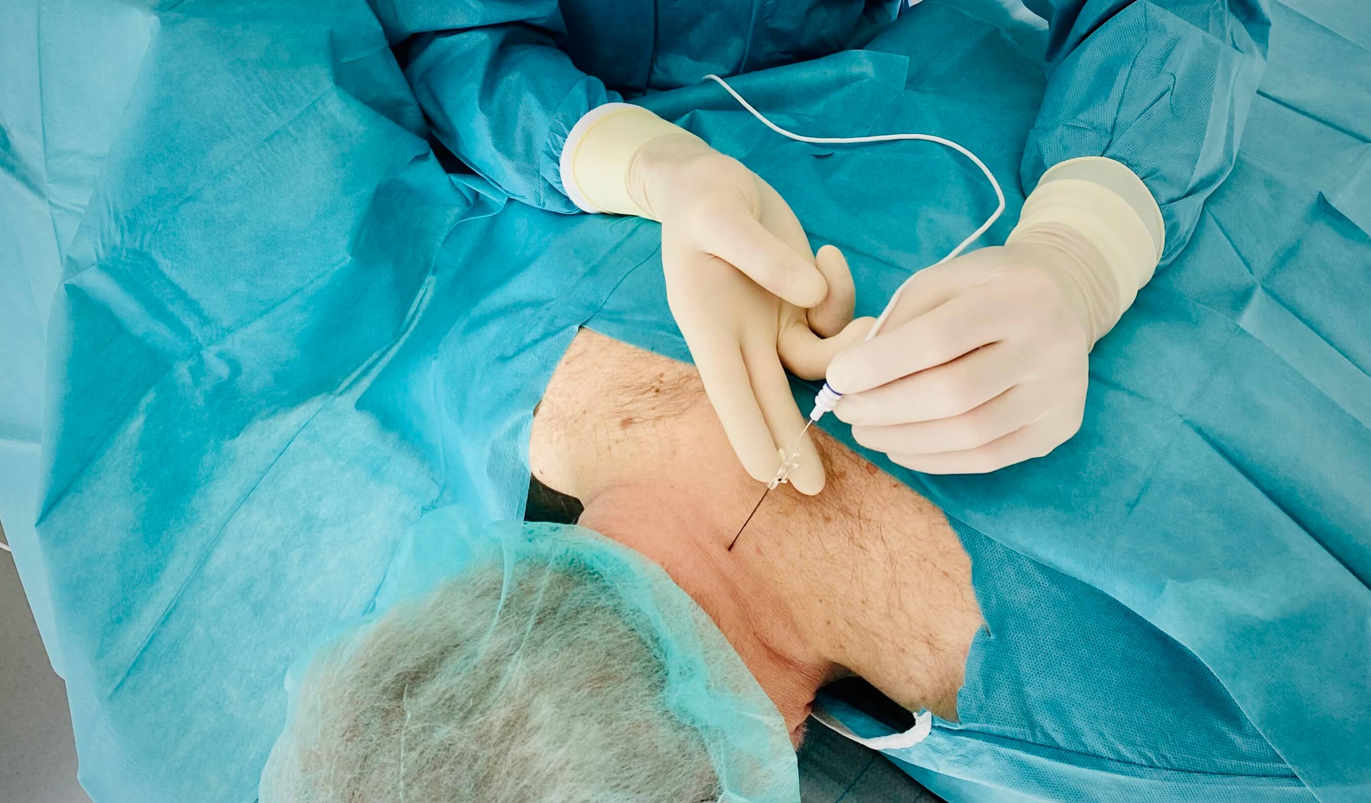 Thermokoagulation der medialen Äste der zervikalen Spinalnerven